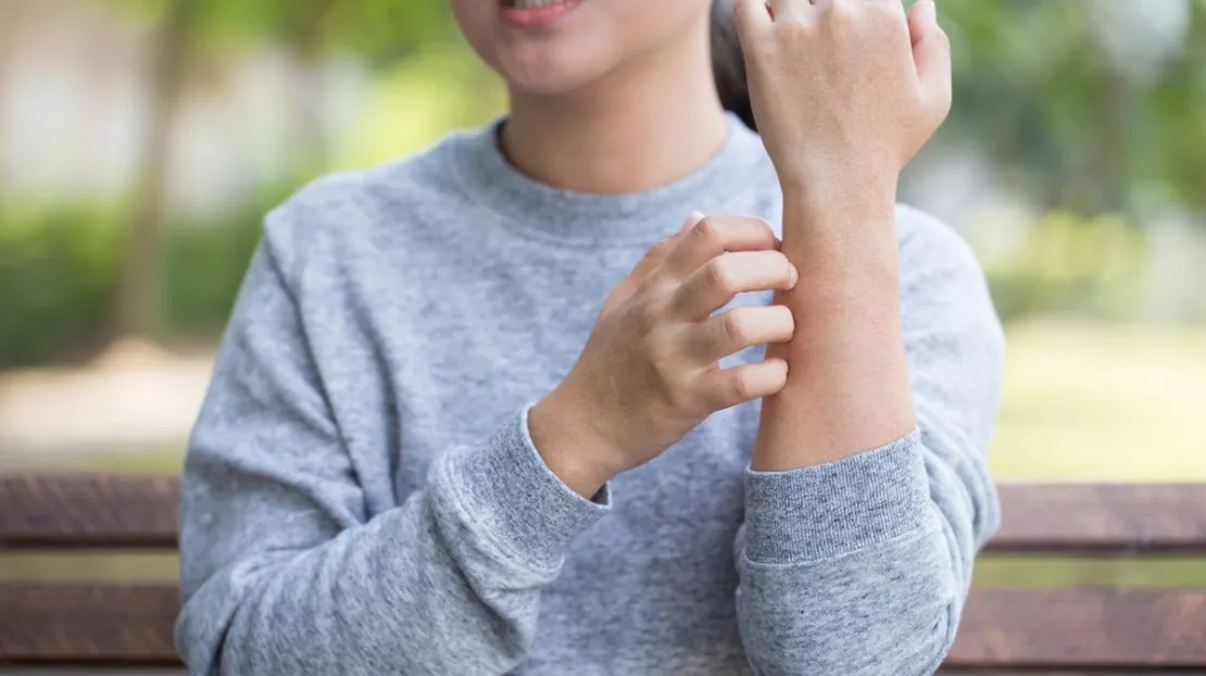 Sering Alami Alergi Dingin? Ini Deretan Penyebabnya!